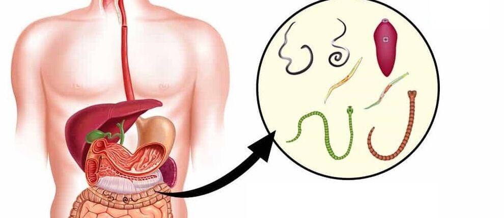 Paraziți în corpul uman