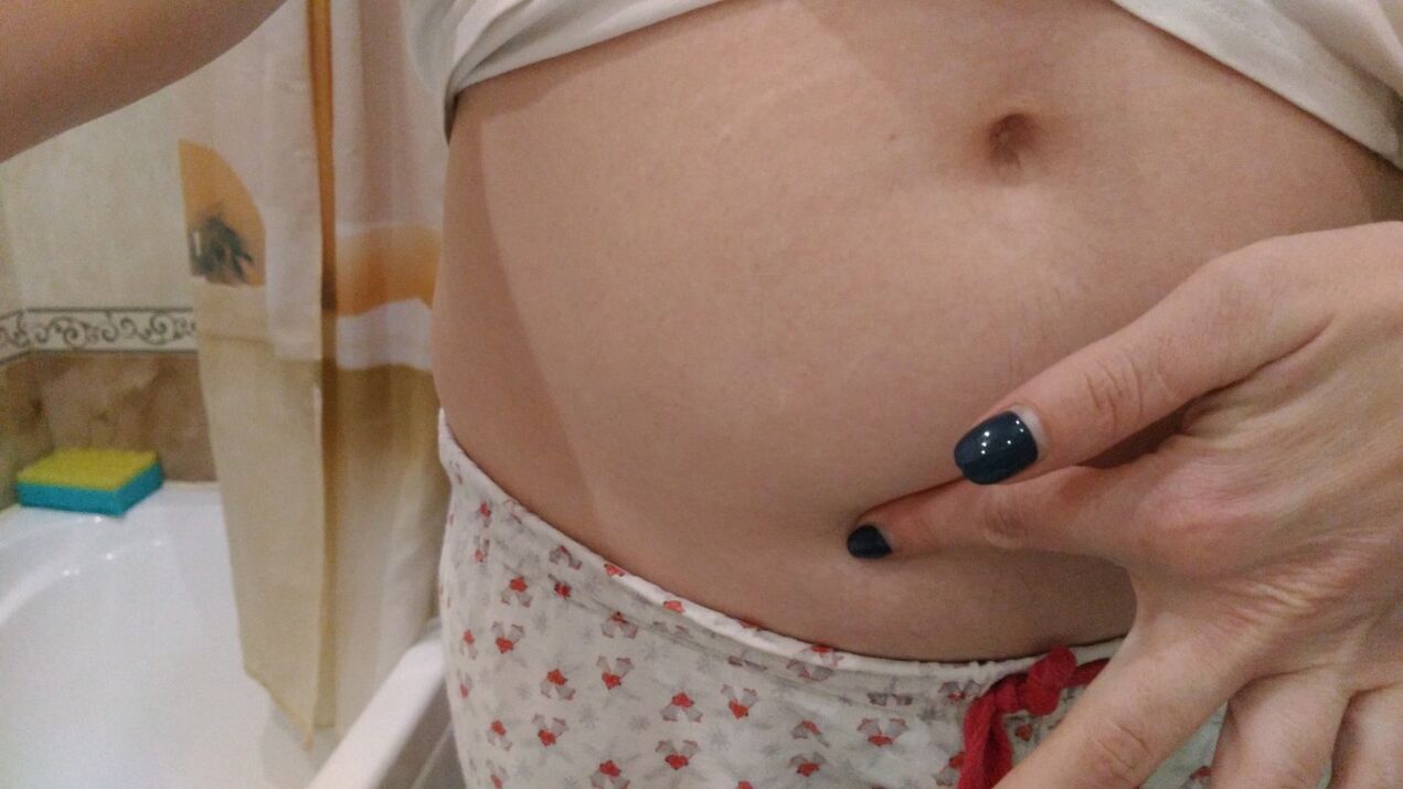 Semne de infecție cu helminți din experiența personală