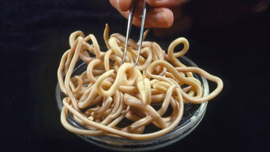 paraziți din corpul uman