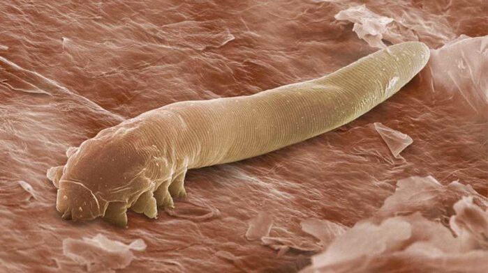 Parazit subcutanat la microscop